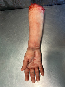 Severed  male right arm