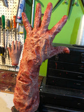 Charger l&#39;image dans la galerie, Burned victim arm